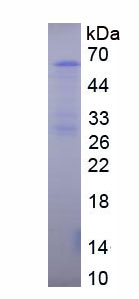 Figure . SDS-PAGE