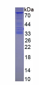 Figure . SDS-PAGE