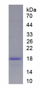 Figure . SDS-PAGE