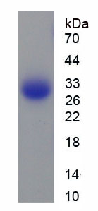 Figure . SDS-PAGE