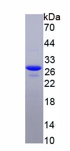 Figure . SDS-PAGE