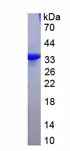 Figure . SDS-PAGE