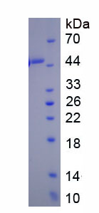 Figure . SDS-PAGE