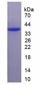 Figure . SDS-PAGE