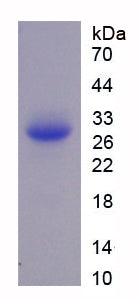 Figure . SDS-PAGE