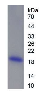 Figure . SDS-PAGE