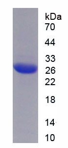 Figure . SDS-PAGE