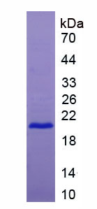 Figure . SDS-PAGE