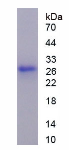 Figure . SDS-PAGE