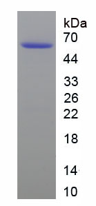 Figure . SDS-PAGE