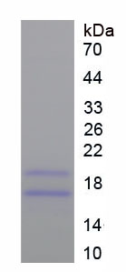 Figure . SDS-PAGE