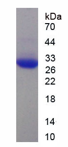 Figure . SDS-PAGE