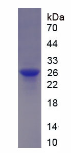 Figure . SDS-PAGE