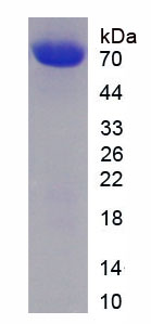 Figure . SDS-PAGE