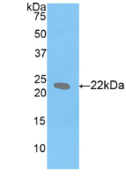Figure . Western Blot