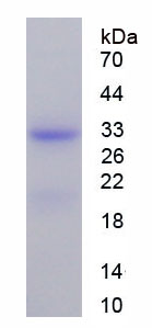 Figure . SDS-PAGE