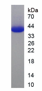 Figure . SDS-PAGE