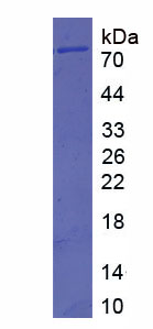 Figure . SDS-PAGE