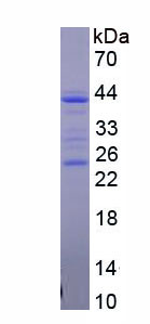 Figure . SDS-PAGE