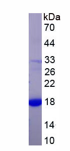 Figure . SDS-PAGE