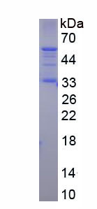 Figure . SDS-PAGE