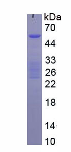 Figure . SDS-PAGE