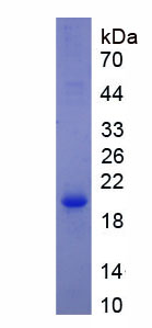 Figure . SDS-PAGE