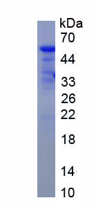 Figure . SDS-PAGE