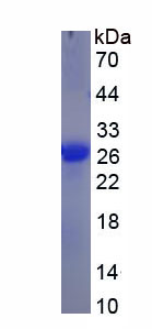 Figure . SDS-PAGE