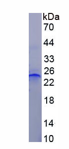Figure . SDS-PAGE