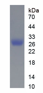 Figure . SDS-PAGE