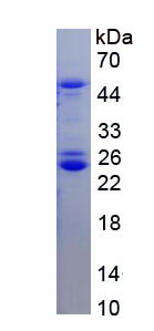 Figure . SDS-PAGE