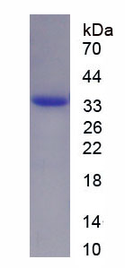 Figure . SDS-PAGE