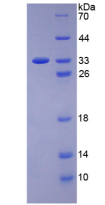 Figure . SDS-PAGE