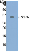 Figure . Western Blot