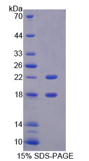 Figure . SDS-PAGE