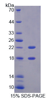 Figure . SDS-PAGE