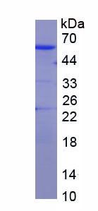 Figure . SDS-PAGE