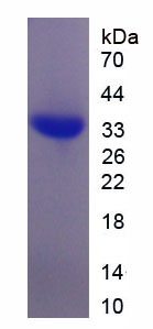 Figure . SDS-PAGE