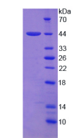 Figure . SDS-PAGE