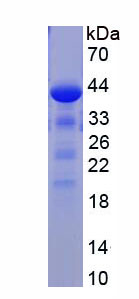 Figure . SDS-PAGE