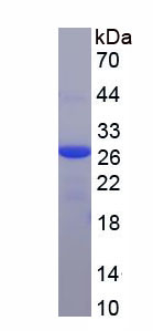 Figure . SDS-PAGE