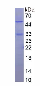 Figure . SDS-PAGE