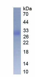 Figure . SDS-PAGE