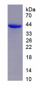 Figure . SDS-PAGE