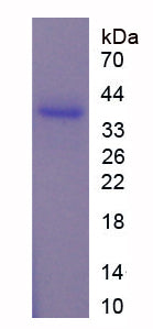 Figure . SDS-PAGE