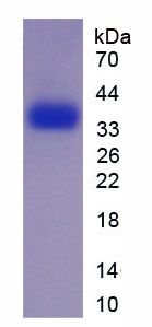 Figure . SDS-PAGE