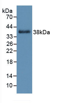 Figure . Western Blot