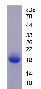 Figure . SDS-PAGE