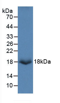 Figure . Western Blot